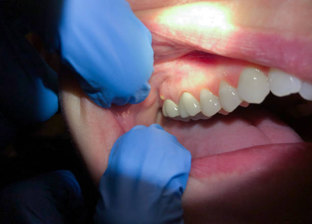 Best Emergency Broken Tooth Repair in Bay Springs, MS